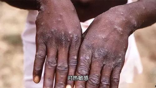 猴子爆料皮肤真假辨别视频,教你轻松辨别皮肤真假 第1张 猴子爆料皮肤真假辨别视频,教你轻松辨别皮肤真假 第1张