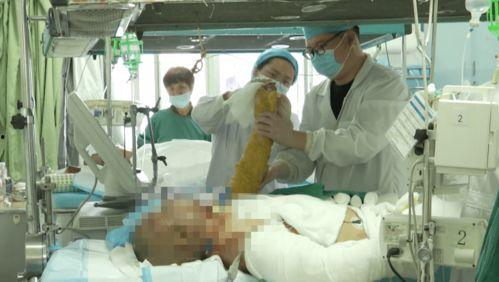如皋医院爆料烧伤视频,惨烈现场令人揪心  第3张